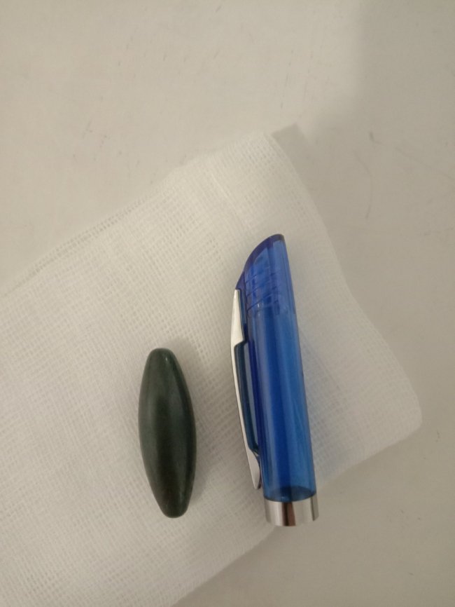 На Волині 2-річний хлопчик проковтнув два магніти, які були прикріплені на холодильнику