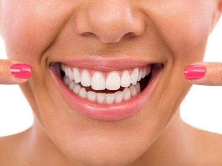 Що таке художня реставрація зубів та кому вона буде корисна