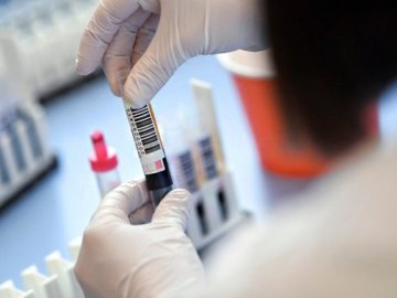 Повідомили про добову ситуацію щодо коронавірусу в Україні