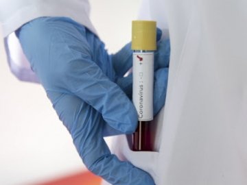 На Волині – 18 людей із підозрою на коронавірус