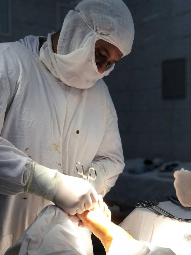 Лікарі прооперували 24-річну волинянку, у якої були викривлені пальці обох стоп 