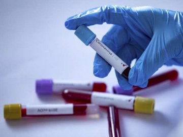 Новий антирекорд кількості хворих на COVID-19 пов'язаний з порушенням карантину на Великдень, – МОЗ