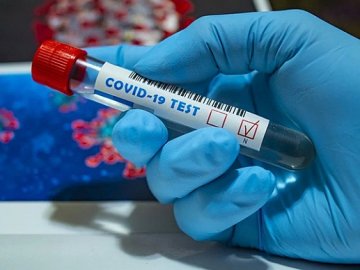 Повідомили статистику щодо коронавірусу в Україні за минулу добу