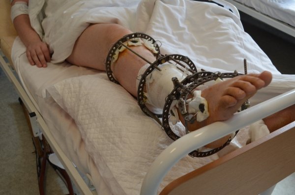 Допомогу волинському бійцеві збирають «усім миром». ФОТО