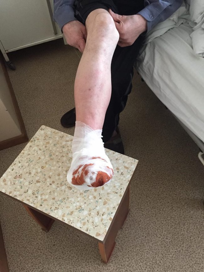 Луцький лікар розповів про небезпечні хвороби та як їх уникнути