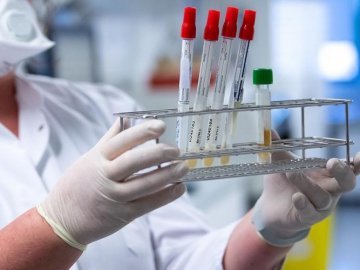 Де у Любешівському районі виявили нові випадки COVID-19