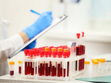 Ранок 28 вересня: в Україні – 2 671 новий випадок коронавірусу, на Волині – знову антирекорд