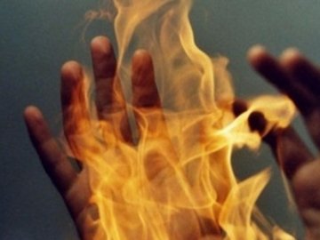 На Волині пенсіонер підпалив себе та помер від опіків, – соцмережі. ФОТО 18+