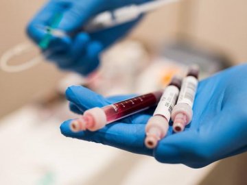 Кількість нових хворих зростає: оприлюднили статистику щодо COVID-19 в Україні за добу