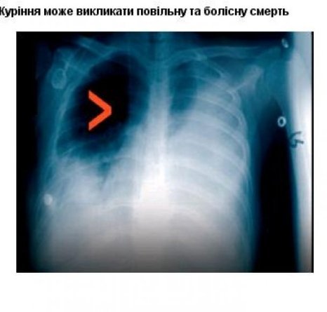 Якими малюнками на пачках цигарок лякатимуть курців. ФОТО