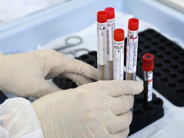 На Волині за останню добу зафіксували 24 нові випадки коронавірусу і одну смерть