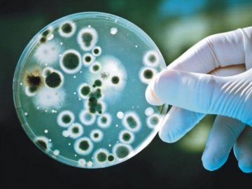 12 випадків вірусного гепатиту А зареєстровано на Волині