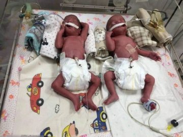 Три хлопчики і одна дівчинка: в Україні жінка народила четвірню