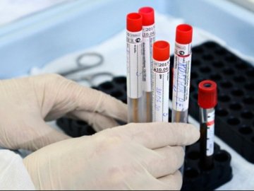 В Україні зафіксували 6 088 нових випадків коронавірусу