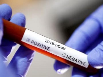 Де на Волині зафіксували нові випадки інфікування коронавірусом