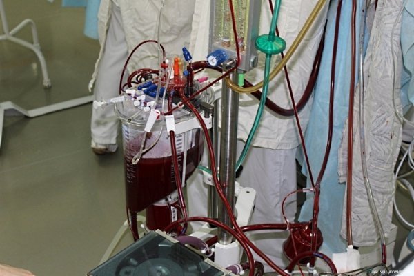 Як роблять операцію на серці у Волинській обласній лікарні. ФОТО. ВІДЕО