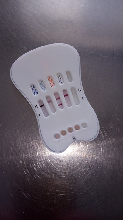 На Волині впровадили експрес-діагностику на ВІЛ, гепатити та сифіліс