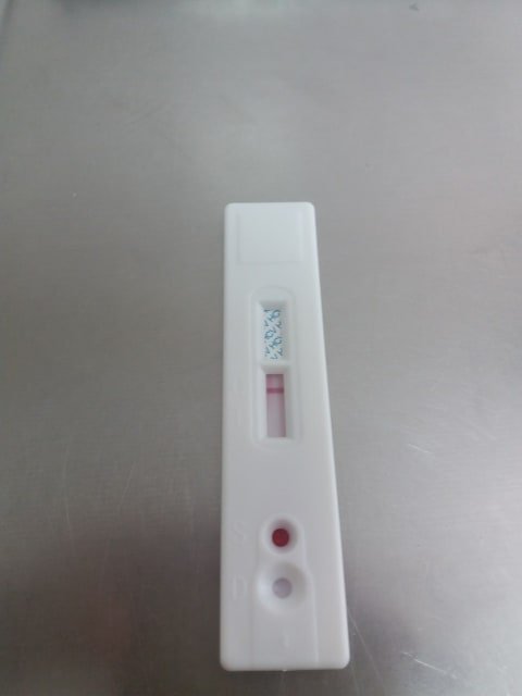 На Волині впровадили експрес-діагностику на ВІЛ, гепатити та сифіліс