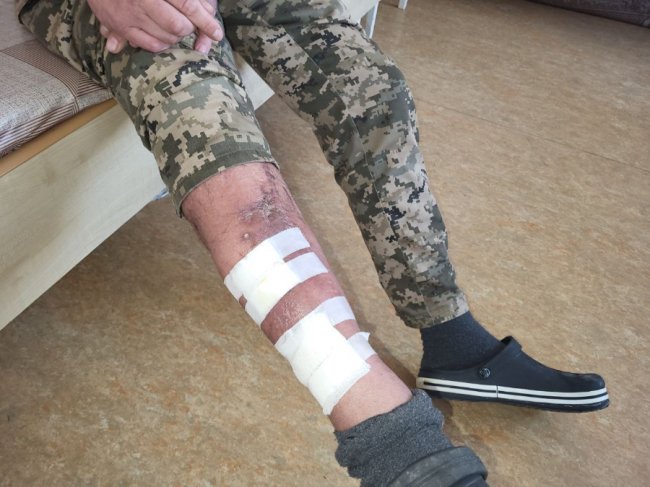 «Не знаю, як мені вдалося вижити»: військовий з Волині півтора року відновлюється від поранення