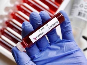 Ситуація з коронавірусом в Україні за добу: оприлюднили статистику