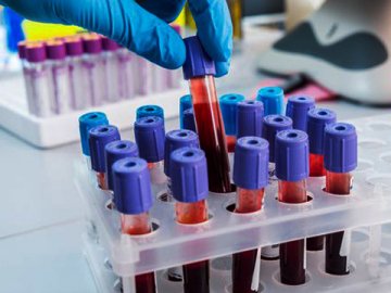 На Київщині через COVID-19 на карантин закрили вже другий дитсадок