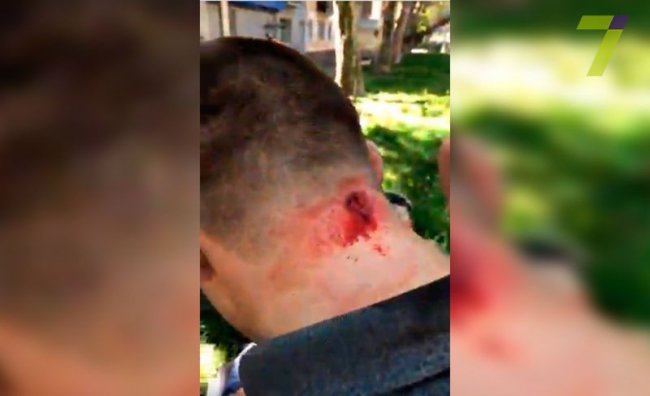 Стріляли у екс-керівника одеського «Правого сектору». ФОТО. ВІДЕО