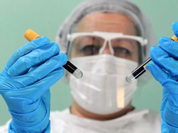 На Волині за минулу добу – 135 нових і 7 летальних випадків коронавірусу 