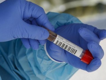 Оприлюднили статистику щодо коронавірусу в Україні за добу