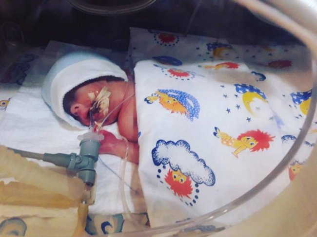 Просять допомогти хлопчику з Луцька, який народився на 6,5 місяці вагітності. ФОТО