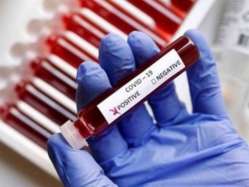 Коронавірус на Волині: 84 людини захворіли, 2 – померли