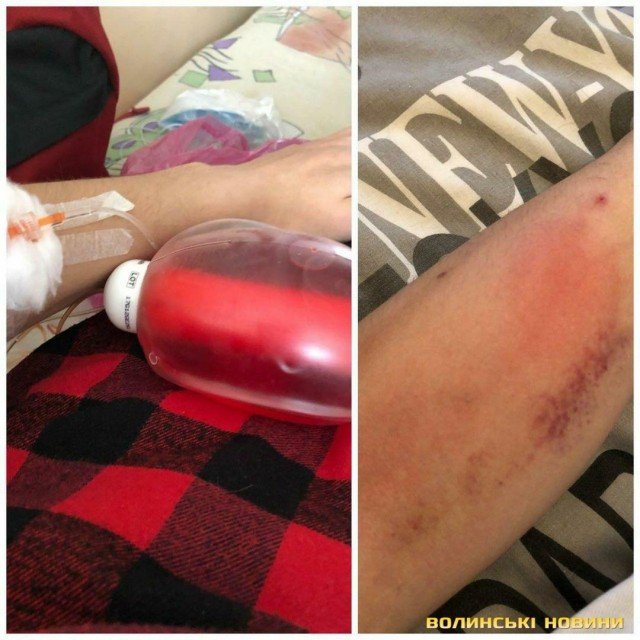 У двадцятирічного юнака, який поборов рак, стався рецидив: хлопець благає про допомогу