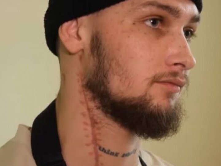 Неймовірна історія: кров для переливання пораненому волинянину доставили дроном