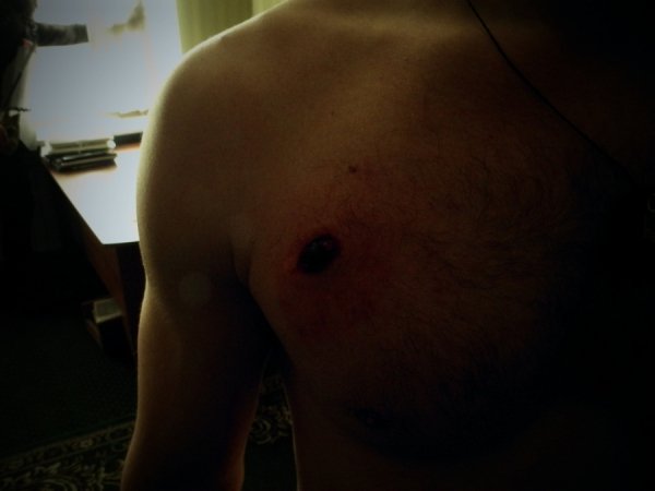 Фото поранених бійців Волинської сотні