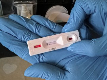 Яка ситуація із захворюваністю на коронавірус  у Любешівському районі