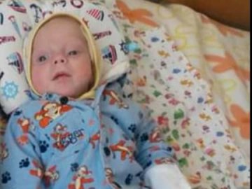 Переніс декілька операцій на мозку: закликають допомогти маленькому волинянину