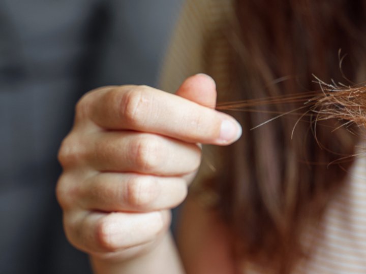 Волосся заповнило третину шлунка: у Луцьку лікарі врятували 7-річну дівчинку