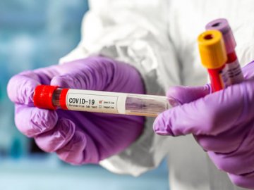 Одинадцять смертей та 317 нових випадків: ситуація з COVID-19 на Волині за останню добу