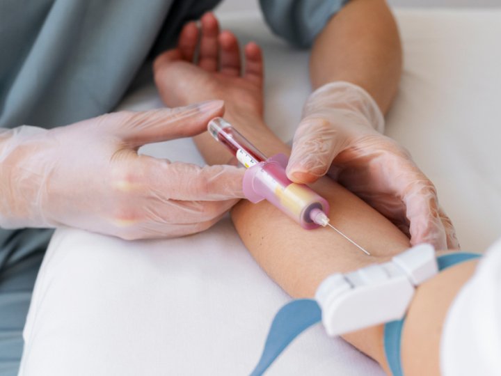 Як інноваційні лабораторні технології допомагають точно виявити гепатит A