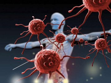 На Волині зросла кількість пацієнтів із раком 4-ї стадії