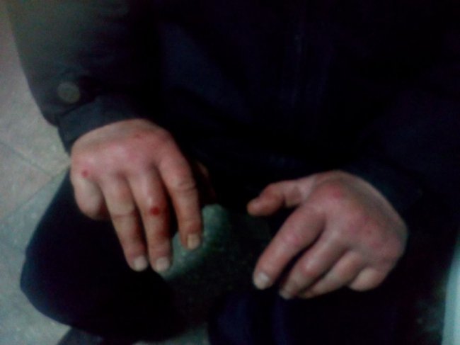 Не міг прийти до тями і ледь говорив: у Луцьку зграя невідомих побила дідуся