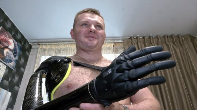 Відсічена рука й осколок, що застряг у щелепі: історія волинського воїна Михайла Бартошика