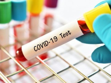 На Волині від коронавірусу померла 18-річна