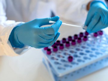 На Львівщині виявили хворих, заражених штамом коронавірусу «Дельта»