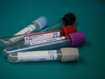 Де на Волині виявили нові випадки коронавірусу станом на 30 червня