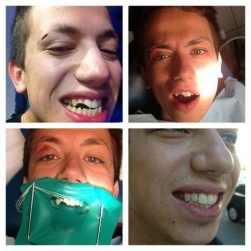 Дурнєва побили на Дніпропетровщині. ФОТО