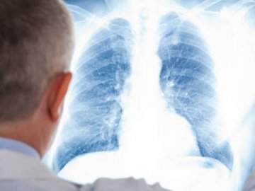 У Нововолинську – 8 хворих із пневмонією 