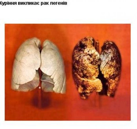 Якими малюнками на пачках цигарок лякатимуть курців. ФОТО