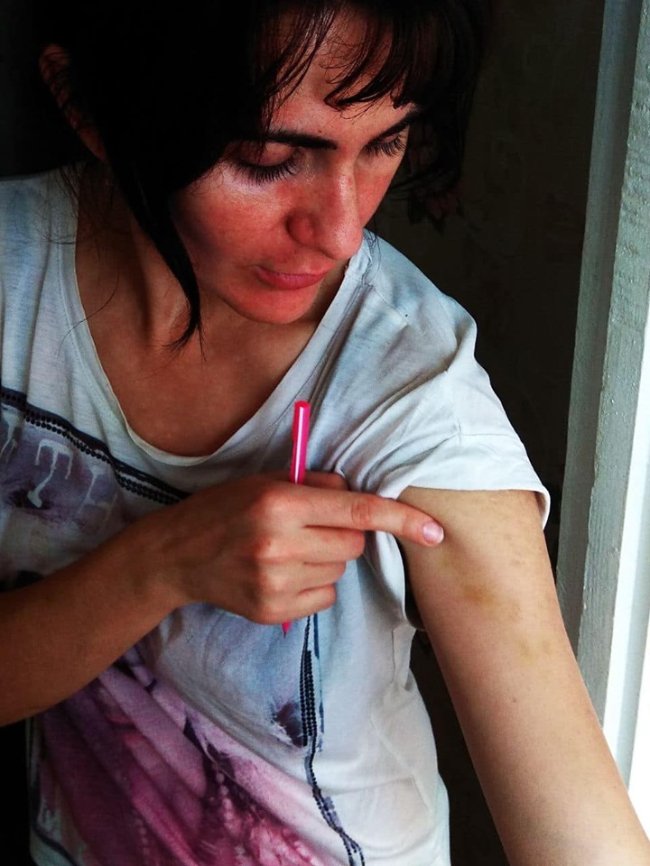 У Рівному чоловік побив дружину та немовля і втік