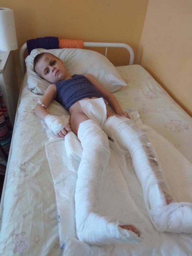 Замкнувся у квартирі і випав з 5-го поверху: мама маленького лучанина просить про допомогу