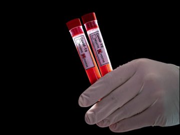 Де на Волині виявили нові випадки коронавірусу станом на 21 червня 